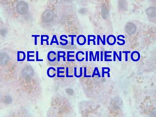 TRASTORNOS DEL CRECIMIENTO CELULAR
