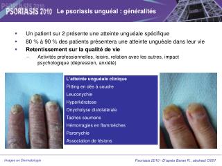 Le psoriasis unguéal : généralités