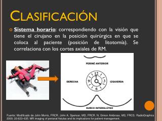 Clasificación