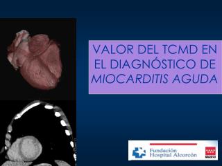 VALOR DEL TCMD EN EL DIAGNÓSTICO DE MIOCARDITIS AGUDA