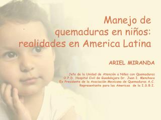 Manejo de quemaduras en niños: realidades en America Latina
