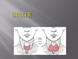 GUATR