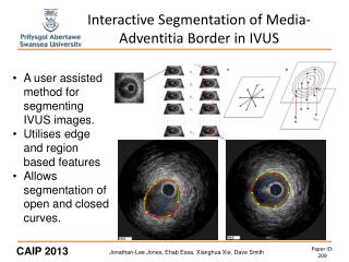 Interactive Segmentation of Media-Adventitia Border in IVUS