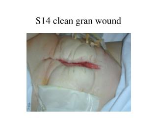 S14 clean gran wound