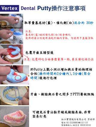可避免石膏沾黏牙縫或樹脂表面 , 非常容易打亮
