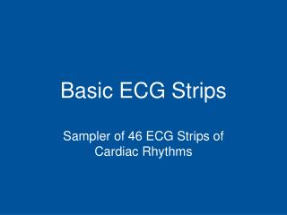 Basic ECG Strips