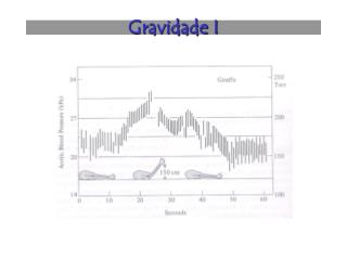 Gravidade I