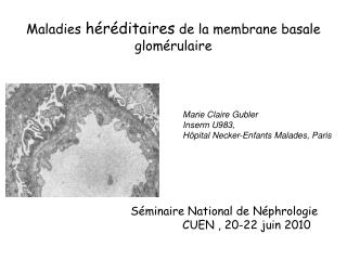 Maladies héréditaires de la membrane basale glomérulaire