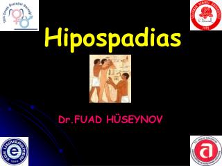 Hipospadias