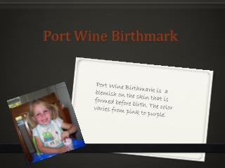 Port Wine Birthmark