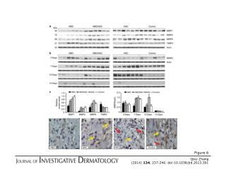 Qixu Zhang (2014) 134 , 237-246. doi:10.1038/jid.2013.301