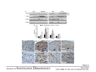 Qixu Zhang (2014) 134 , 237-246. doi:10.1038/jid.2013.301