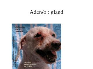 Aden/o : gland