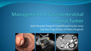 Management of Gastrointestinal Stromal Tumor