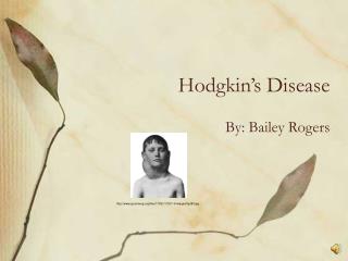 Hodgkin’s Disease