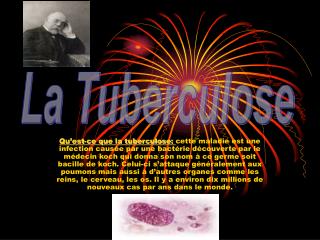 La Tuberculose