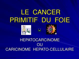 LE CANCER PRIMITIF DU FOIE HEPATOCARCINOME OU CARICINOME HEPATO-CELLULAIRE