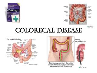 COLORECAL DISEASE