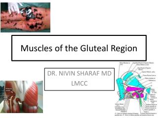 Muscles of the Gluteal Region