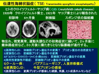 伝達性海綿状脳症 （ TSE: Transmissible spongiform encephalopathy ）
