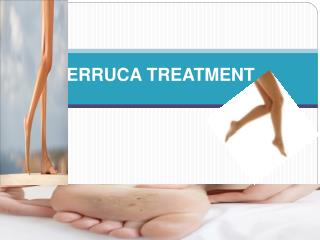 VERRUCA TREATMENT