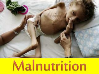 Malnutrition