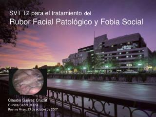 SVT T2 para el tratamiento del Rubor Facial Patológico y Fobia Social