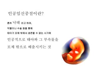 인공임신중절이란 ?