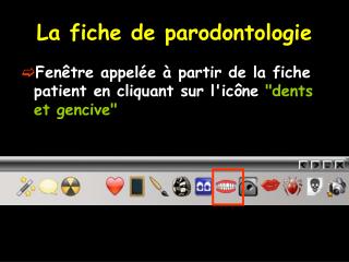 La fiche de parodontologie