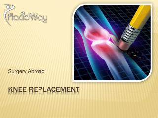 Knee Replacement Surgery Helps You Enjoy Life Again