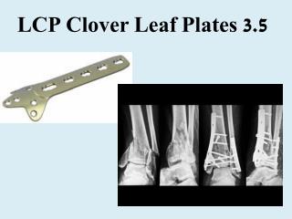 LCP Clover Leaf Plates 3.5
