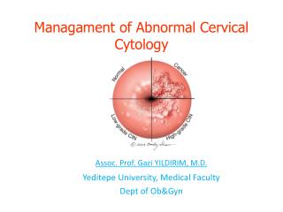 Managament of Abnormal Cervical Cytology
