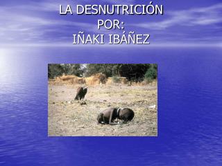 LA DESNUTRICIÓN POR: IÑAKI IBÁÑEZ