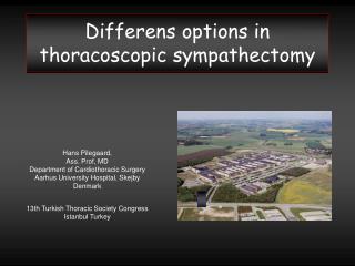 Differens options in thoracoscopic sympathectomy