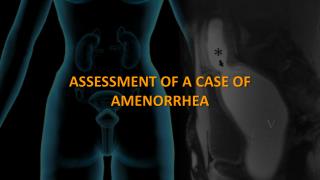 ASSESSMENT OF A CASE OF AMENORRHEA