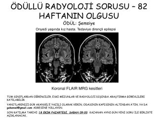 ÖDÜLLÜ RADYOLOJİ SORUSU – 82 HAFTANIN OLGUSU ÖDÜL: Şemsiye