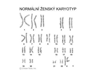 NORMÁLNÍ ŽENSKÝ KARYOTYP