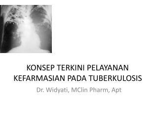 KONSEP TERKINI PELAYANAN KEFARMASIAN PADA TUBERKULOSIS