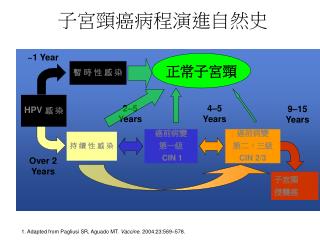 子宮頸癌病程演進自然史