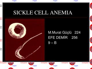 SICKLE CELL ANEMIA