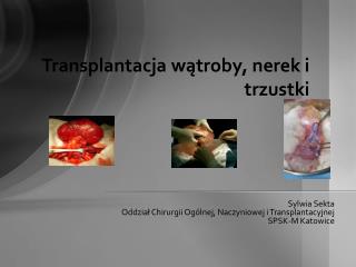 Sylwia Sekta Oddział Chirurgii Ogólnej, Naczyniowej i Transplantacyjnej SPSK-M Katowice