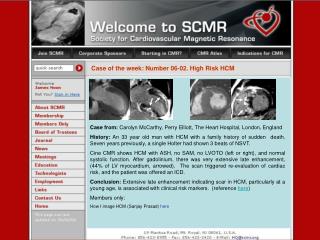 Case of the week: Number 06-02. High Risk HCM