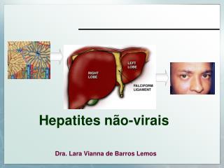 Hepatites não-virais