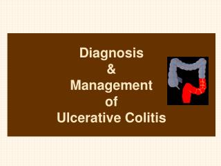 Diagnosis &amp; Management of Ulcerative Colitis