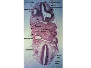 PHARYNGEAL ARCHES 01