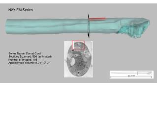 Series Name: Dorsal Cord Sections Spanned: 536 (estimated) Number of Images: 195