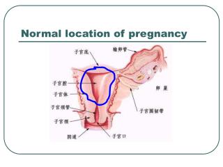 Normal location of pregnancy