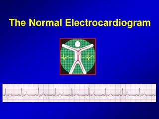 The Normal Electrocardiogram