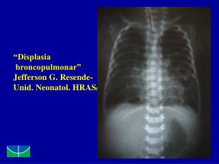 “Displasia broncopulmonar” Jefferson G. Resende- Unid. Neonatol. HRAS/SES/DF