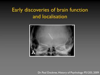 Early discoveries of brain function and localisation